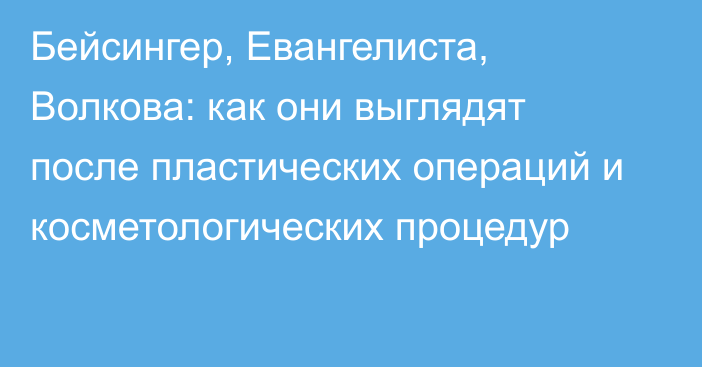 Бейсингер, Евангелиста, Волкова: как они выглядят после пластических операций и косметологических процедур